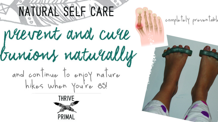 Thrive Primal - prevent and cure bunions naturally