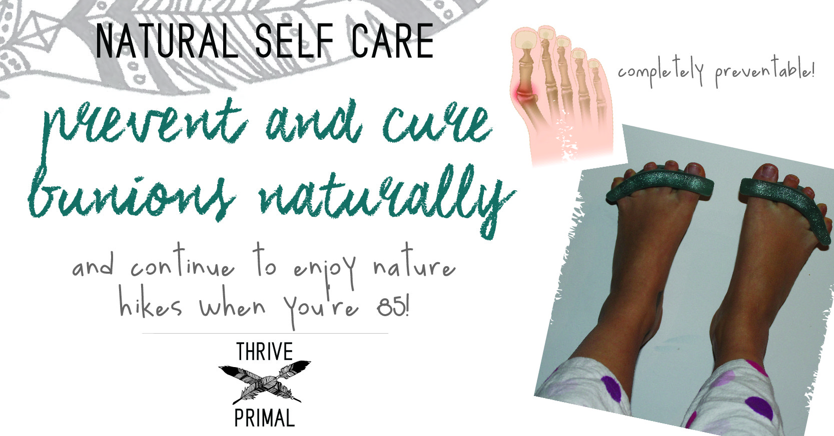 Thrive Primal - prevent and cure bunions naturally